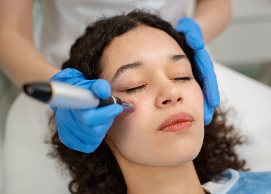 Dermapen (Microneedling)